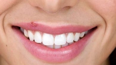 تاول ویروسی | تبخال | علل بروز تبخال