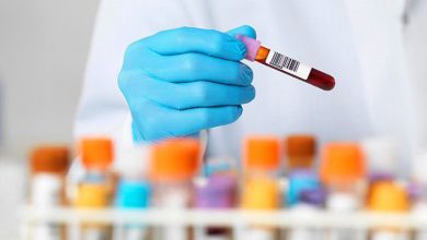 آزمایش قبل بارداری | چاپ بارداری