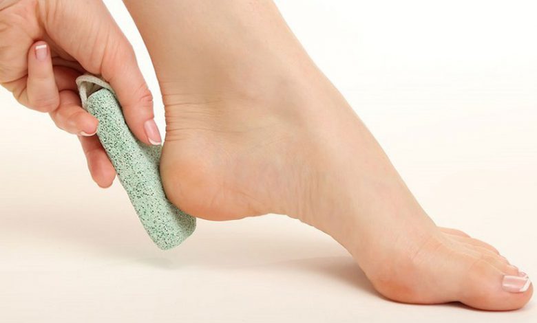 اپیدرمیس | ترک پاشنه