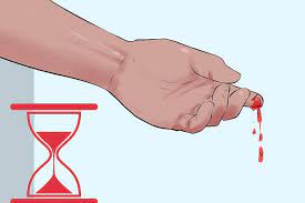 تالاسمی | هموفیلی | هموفیلی نوع B