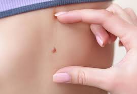 آفتاب‌سوختگی | سرطان پوست | نور ماوراء بنفش