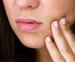 آفت دهان | بیماری دهان و لثه | پیشگیری از آفت دهان