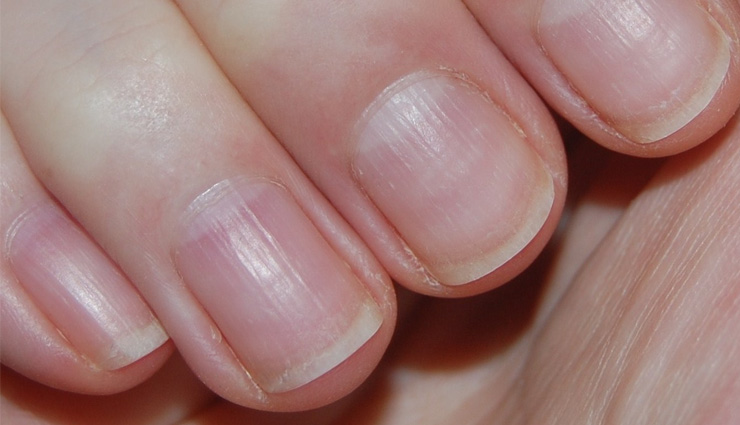 خط خطی شدن ناخن ها خط خطی شدن ناخن ها | خطوط افقی روی ناخن | خطوط روی ناخن