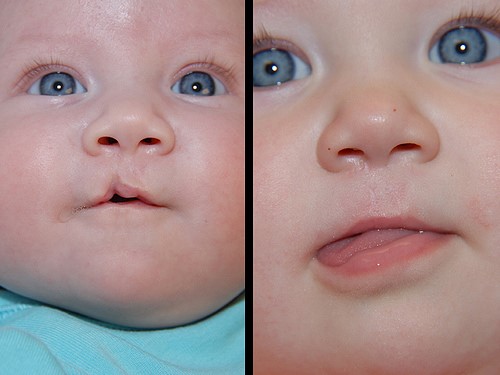 کودکان و مادران