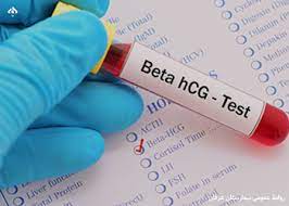 اقدامات لازم بعد از استفاده از تست بارداری | انواع تست‌ بارداری