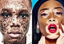 زیباترین بیماری های دنیا