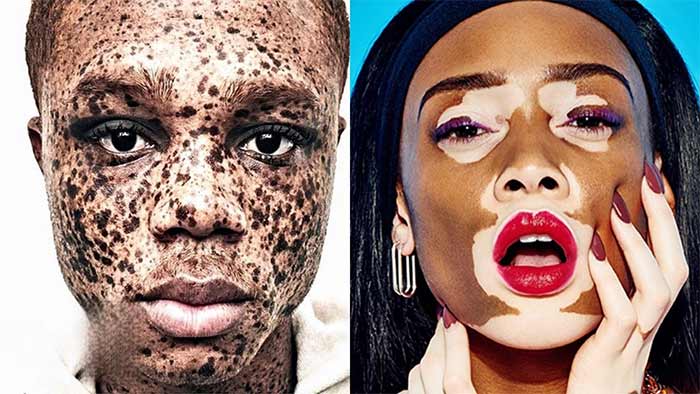 زیباترین بیماری های دنیا