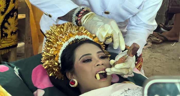 رسم تیز کردن دندان